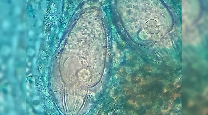 Saúde/Santiago: Cientista confirma novo surto de esquistossomose em São Miguel e diz desconhecer origem